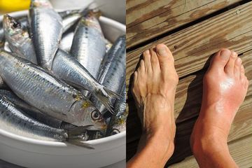 Berikut ini tiga ikan yang pantang dimakan orang yang idap asam urat
