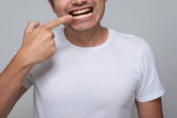 Perawatan untuk mengatasi gigi kuning.