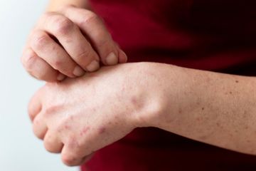8 Gejala Diabetes Akut, Waspada dan Segera Periksa Bila Mengalaminya
