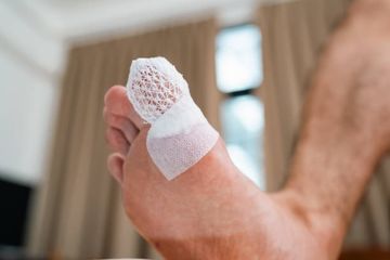 6 Cara Tradisional Menghilangkan Cantengan di Kaki, Mudah Dilakukan di Rumah