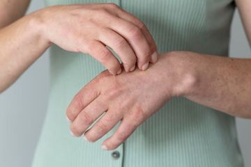 Tangan Sering Gatal Setelah Cuci Piring? Ini Penyebab dan Cara Mengatasinya