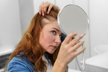Mengungkap Penyebab Kebotakan Dini pada Wanita, Faktor-faktor yang Perlu Diketahui