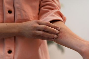 Tanda Diabetes di Kulit yang Perlu Diwaspadai, Deteksi Dini untuk Kesehatan Lebih Baik