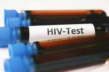 Daftar Klinik di Bandung yang Sediakan Tes HIV/AIDS dan Biayanya