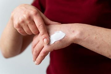 Risiko mpox selama kehamilan