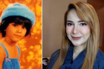 Mantan Penyanyi Ciliki Puput Novel Meninggal Dunia karena Kanker Payudara, Simak Ciri-ciri Kanker Payudara pada Wanita