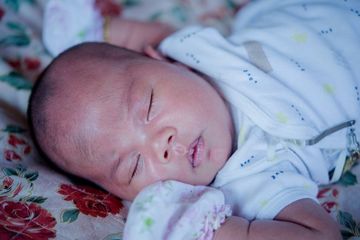 Apakah Bayi Bisa Kena Stroke?