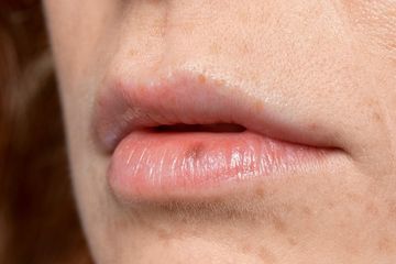 Penyebab Bibir Kering Walaupun Sudah Minum Banyak Air, Nomor 2 Sering Dilakukan Orang