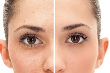 Ajaib Buah Ini Ternyata Ampuh Menghilangkan Flek Hitam Pada