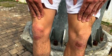 Kondisi Lutut Thom Haye Lebam Setelah Gagal Seleberasi di Rumput SUGBK