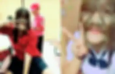 Dulu Wajahnya Dipenuhi Bulu Akibat Idap Sindrom Langka, Kini Penampilannya Bikin Pangling Setelah Seluruh Bulunya Dicukur, Lihat Penampilannya Sekarang