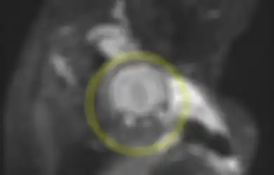 Bukannya Kaget, Pasangan Ini Justru Terpingkal-pingkal Setelah Melihat Foto MRI Anaknya