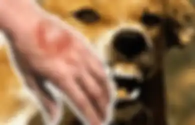 619 Orang Jadi Korban Serangan Anjing Gila, 6 Orang Meninggal: Segera Lakukan Ini jika Digigit Hewan Rabies