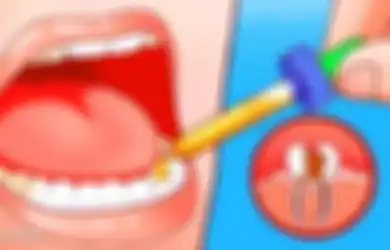 Dengan 5 Bahan Alami Ini, Sakit Gigi Tak Tertahan Reda dalam 1 Menit