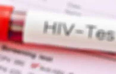 3 Bocah Penderita HIV Dikucilkan: Penyebab Terbesar HIV Memang Hubungan Seksual, Tapi Jangan Abaikan Penyebab Ini