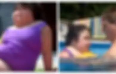 5 Kisah para 'Putri Duyung' di Dunia Nyata, Selalu Divonis Tak Akan Berumur Panjang oleh Medis