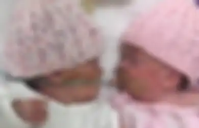 Bikin Nangis, Inilah Momen Mengharukan Ketika Bayi Kembar Memeluk Kembarannya yang Sedang Sekarat