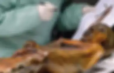 Mumi Tertua di Eropa Ini Tunjukkan Penyakit 'Purba' Manusia Zaman Dahulu, Kira-Kira Apa Ya?