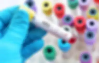 3 Siswa SD yang Tertular HIV Mau Diusir, Ini Alasan Remaja Rentan Terkena HIV