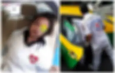 Peringatan! Wanita Ini Nyaris Buta Setelah Taksi yang Ditumpanginya Alami Kecelakaan saat Dirinya Sedang Berdandan