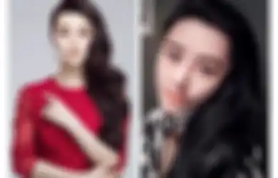 Demi Mirip Artis Idola, Wanita Ini Rela Jalani Operasi Plastik Hingga 8 Tahun, Lihat Hasilnya Ini!