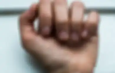 Dari Gangguan Tiroid Hingga Anemia, Begini Cara Cek Kesehatan Lewat Tangan