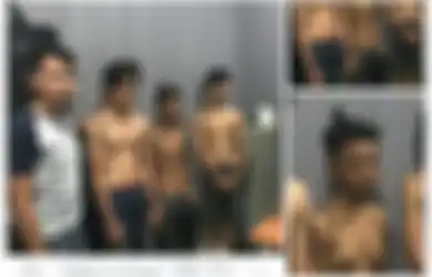 Viral! Foto Pemuda Miliki Payudara, Ternyata Ini Penyebab dan Gejalanya