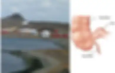 Aneh, Kota Kecil Ini Wajibkan Warganya Buang Usus Buntu, untuk Apa?