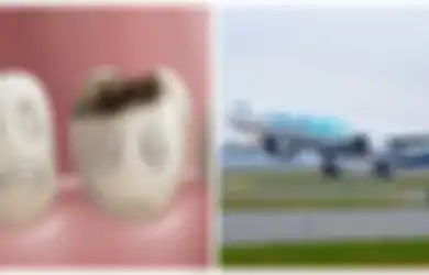 Jangan Pernah Naik Pesawat Terbang Jika Punya Gigi Berlubang , Ini Alasannya!