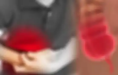 Ini Makanan yang Sebaiknya Tidak Boleh Dimakan Setelah Operasi Usus Buntu