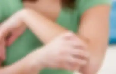 7 Tips untuk Obat Biduran Kronis, Termasuk Kelola Emosi Anda