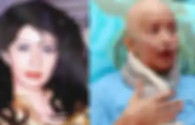 7 Artis Indonesia dan Ani Yudhoyono Meninggal Karena Kanker, Bisa Jadi Ini Penyebabnya
