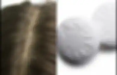 Gunakan Campuran Aspirin dan Cuka untuk Masker Rambut, Masalah Ketombe Akan Segera Tuntas