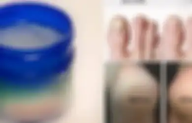10 Manfaat Vaporub yang Jarang Diketahui, Bisa Atasi Tumit Pecah-pecah hingga Hilangkan Selulit