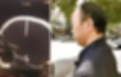 Dokter Temukan Paku Ukuran 4,8 cm di Kepala Pria yang Berulang Kali Mengeluh Sakit Kepala Ini, Mengerikan!