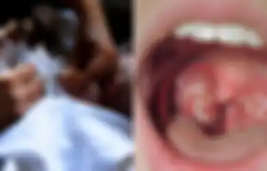 Orangtua Tolak Beri Imunisasi Difteri, Bayi 14 Bulan Meninggal Dunia, Miris