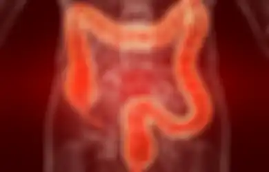 Tiga Bulan Alami Sembelit, Seluruh Usus Pria Ini Harus Diangkat