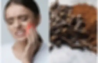 3 Cara Menggunakan Cengkeh untuk Meredakan Sakit Gigi dalam Hitungan Menit