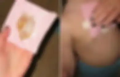 Seumur Hidup Baru Tau Ada Trik Ini,  Cuma Modal Bahan-Bahan Dapur Ini, Berikut Cara Ampuh Sembuhkan Batuk Berdahak Tanpa Obat