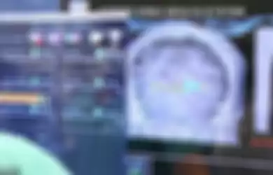 Kondisi otak Greg setelah di scan