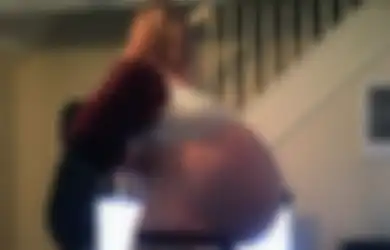 Sempat Dikira Hamil, Perut Wanita Ini Ternyata Membesar karena 'Mengandung' Kista Seberat 26 Kg