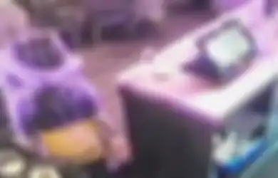 Wanita Ini Pingsan Lalu Wajahnya Lumpuh Setelah Dipeluk Temannya, Kok Bisa?