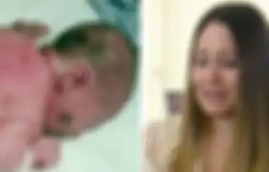 Bayi Ini Lahir dengan Tubuh Dipenuhi Tahi Lalat, Ibunya Menangis Takut Anaknya Di-bully Ketika Dewasa Nanti