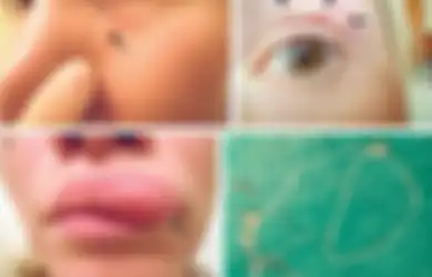 7 Kasus Kesehatan Paling Aneh di Tahun 2018, Salah Satunya Amoeba Memakan Otak Seorang Wanita