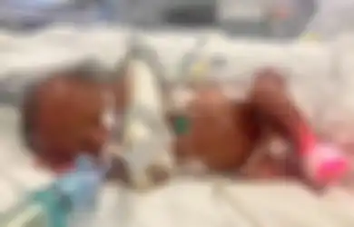 Lahir dengan Berat Kurang Dari 1 Kilogram dan Diprediksi Alami Kerusakan Otak, Bayi Ini Tumbuh Mengagumkan!