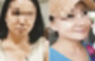 Hidup Nelangsa dan Gagal Menikah karena Berwajah 'Jelek,' Wanita Ini Lakukan Operasi Plastik dan Mengubah Nasibnya