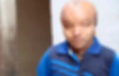 Kisah Menyedihkan Pria Berjuluk 'Alien' yang Ingin Dioperasi Karena Ingin Jatuh Cinta dan Menikah