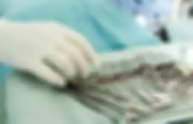 5 Transplantasi Organ Paling Menarik, Ada Transplantasi Mr. P hingga Wajah