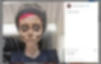 Masih Ingat Penggemar Berat Angelina Jolie yang Mengklaim Lakukan 50 Operasi Plastik? Ini Kabar Barunya