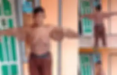 Mengenal Operasi Bariatrik yang Bantu Arya Turunkan Berat Badan Hingga 100 Kg